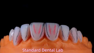 Standard Dental Lab Co., Limited خط إنتاج المصنع