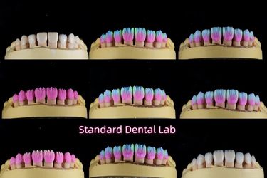Standard Dental Lab Co., Limited خط إنتاج المصنع