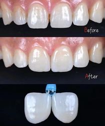 Standard Dental Lab Co., Limited خط إنتاج المصنع