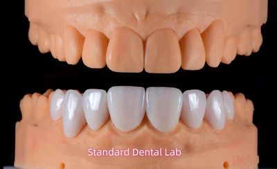 Standard Dental Lab Co., Limited خط إنتاج المصنع
