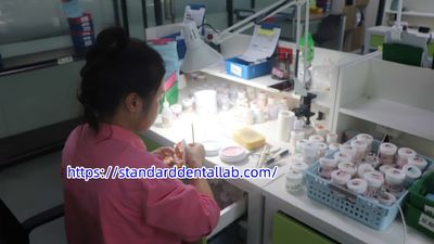 Standard Dental Lab Co., Limited خط إنتاج المصنع