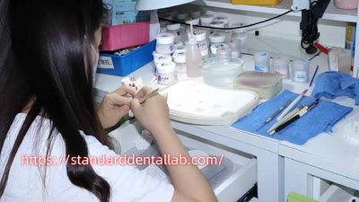 Standard Dental Lab Co., Limited خط إنتاج المصنع