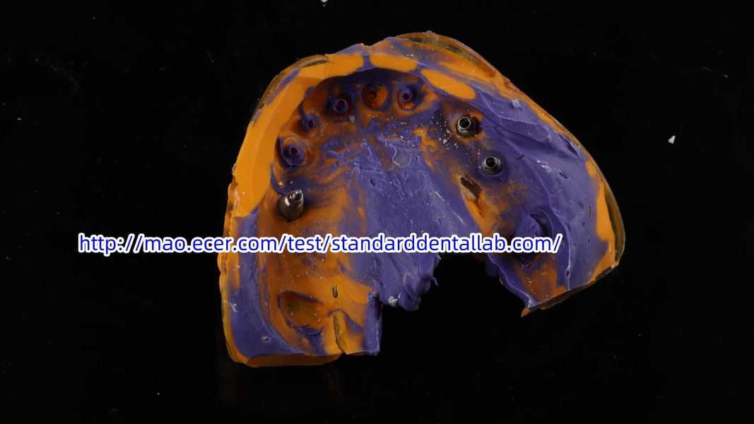 Standard Dental Lab Co., Limited خط إنتاج المصنع