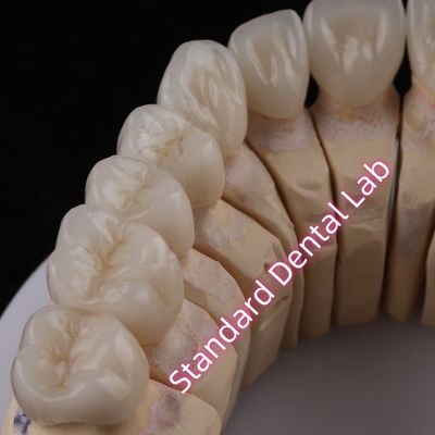 شراء معمل الأسنان الرقمي CAD CAM PFZ التاج الشفاف التاج الزركونيا الطبقي التصنيع عبر الإنترنت
