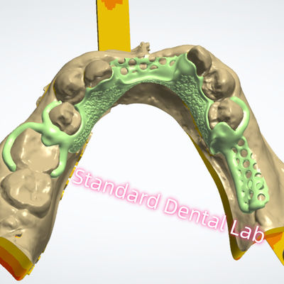 شراء تصميم الإطار المعدني الطباعة بالليزر الصب الكروم الجزئي التصنيع عبر الإنترنت