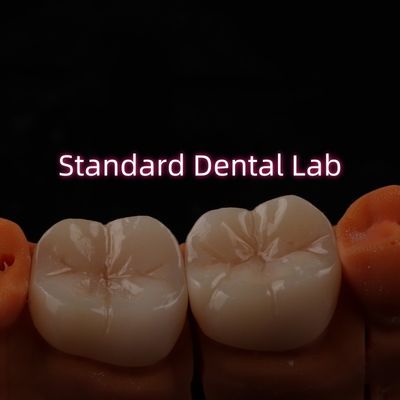 شراء معمل أسنان الكونتور الكامل بروكسيير المونوليتيك سيركونيا كراون بريدج التصنيع عبر الإنترنت