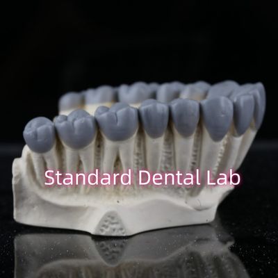 شراء مختبر SDL للأسنان التشخيص الرقمي الشمع فوق الجسر التاج التصنيع عبر الإنترنت