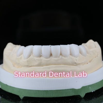 شراء التشخيص الطب الأسنان الترميمي الشمع فوق القشرة جمالية عالية التصنيع عبر الإنترنت