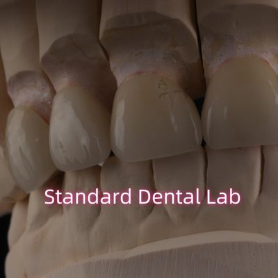 شراء مختبر الأسنان المهنية تاج الزركونيا للترميم الثابت التصنيع عبر الإنترنت