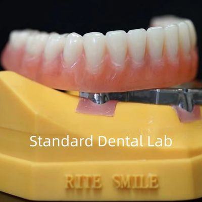 شراء أطقم أسنان مدعومة بالزرع من التيتانيوم أطقم أسنان دقيقة فوق الزرع ISO FDA CE التصنيع عبر الإنترنت