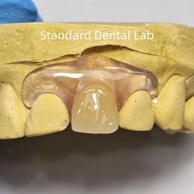 شراء الأسنان TCS Valplast أسنان جزئية مرنة ملطخة مقاومة للروائح المتلاشية التصنيع عبر الإنترنت