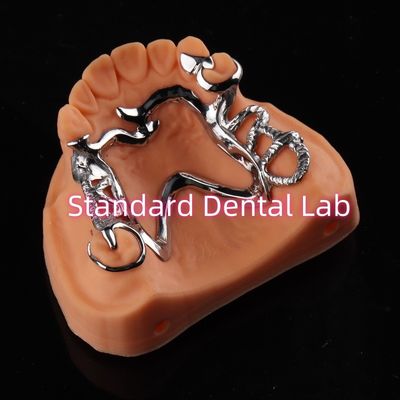 شراء كوبالت كروم إطار ناي كن حرة أطقم أسنان قابلة للإزالة الصين مختبر الأسنان التصنيع عبر الإنترنت