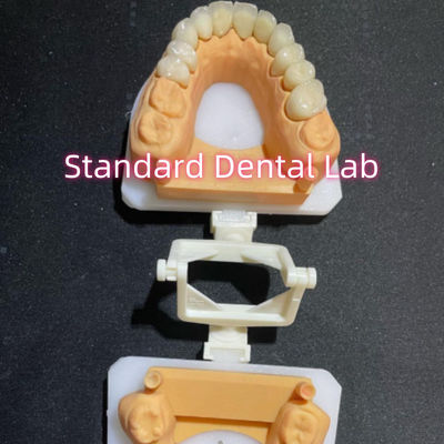 شراء طب الأسنان التجديدية طب الأسنان العناية الفموية كاملة التاج الزركونيا مخصصة التصنيع عبر الإنترنت
