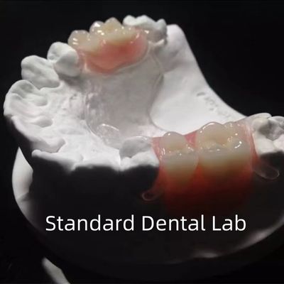 شراء هيكل معدني صاف مرن إطار معدني مرن أطقم أسنان جزئية جمالية عالية تناسب مثالي التصنيع عبر الإنترنت