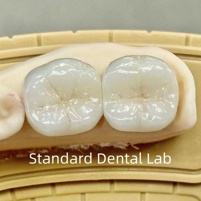 شراء تاج مختبر الأسنان الشفاف الزركونيا مع قوة متفوقة التصنيع عبر الإنترنت