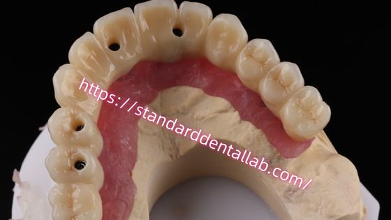 شراء جسر الزرع متعدد الطبقات الزركونيا المسمار المحافظ عليه متوافق بيولوجي على الهيكل المعدني التصنيع عبر الإنترنت