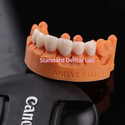 شراء الراحة والوظائف مع معمل CAD CAM الأسنان الرقمي التصنيع عبر الإنترنت