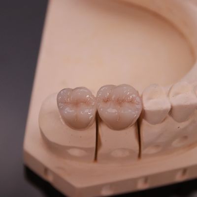 شراء تاج زيركونيا مريح مع الانتهاء الجمالي الدقيق التصنيع عبر الإنترنت