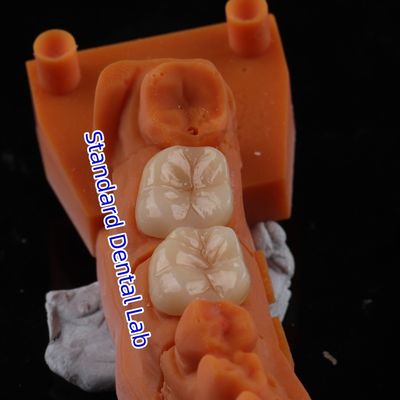 شراء السترة الزركونية الشفافة 3D PRO بدون طبقة البورسلين التصنيع عبر الإنترنت