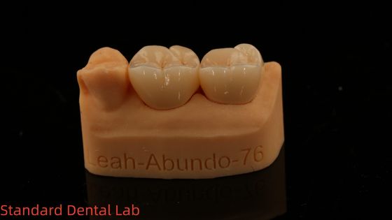 شراء تاجات المختبرات الأسنانية الصلبة 3D Pro عالية الشفافية تاجات الزركونيا الكاملة مع ضمان 5 سنوات التصنيع عبر الإنترنت