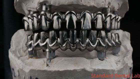 شراء طبيب الأسنان (هايبريد مالو) جسر زرع المهنية مناسبة تماماً معتمدة من الهيئة التصنيع عبر الإنترنت
