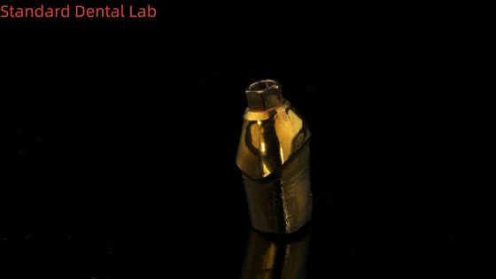 شراء أظافر التيتانيوم النقي المخصصة الحل المثالي لاستعادة الأسنان التصنيع عبر الإنترنت