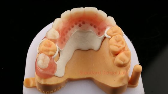 شراء تصميم الإطار الجزئي لمختبر الأسنان ISO CE و FDA الإطار الجزئي للأسنان التصنيع عبر الإنترنت