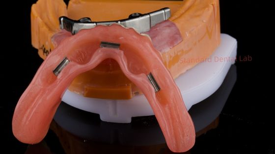 شراء Ivoclar طبقة الأسنان الرقمية العصبية مع المرفقات العصبية الأكريليك الكاملة العصبية التيتانيوم العظام العصبية معتمدة التصنيع عبر الإنترنت
