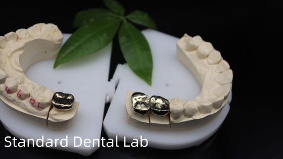 شراء المهنية منظمة الصحة الدولية و FDA المعتمدة الذهب الأصفر التاج لمختبر الأسنان الشحن UPS أو فيدكس وقت الإنتاج 2 أيام التصنيع عبر الإنترنت