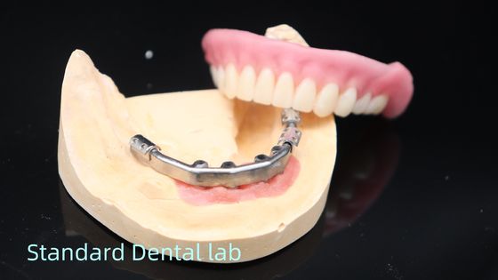 شراء أطقم أسنان مدعومة بالزرع من التيتانيوم أطقم أسنان دقيقة فوق الزرع التصنيع عبر الإنترنت