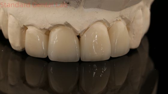 شراء تاج زيركونيا قوي و جسر في جماليات جيدة زيركونيا طبقة الصين مختبر الأسنان التصنيع عبر الإنترنت