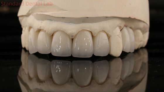 شراء الصين مختبر الأسنان الزركونيا الكاملة المخطط التاج عالية الجمال الجسر الطبيعي الأسنان 5 سنوات ضمان التصنيع عبر الإنترنت