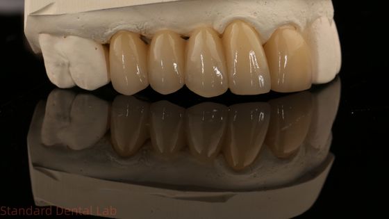 شراء نوريتاكي بورسيلاني كامل المخطط زيركونيا تاج عالي الجمال الطبيعي مخصص زيركونيا جسر الأسنان التصنيع عبر الإنترنت