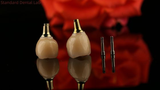 شراء البورسلين الزركونيا الاسمنتية المستمرة الزرع المسمار شكل الرأس الستة الأطراف لتناسب الجمالية المخصصة التصنيع عبر الإنترنت