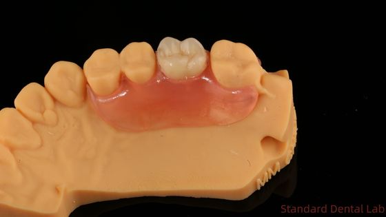 شراء أسنان TCS Valplast مرنة الأسنان الجزئية Nesbit Valplast النهاية الصين مختبر الأسنان Valplast مقفل التصنيع عبر الإنترنت
