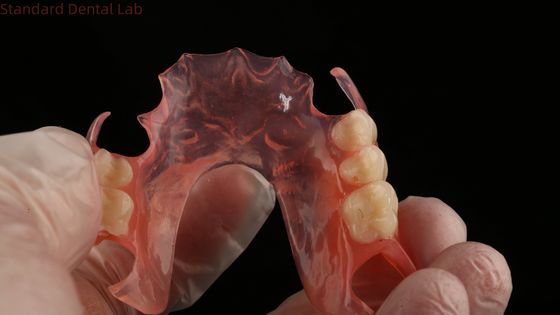 شراء الأسنان الزهرية / الداكنة TCS Valplast الأسنان الجزئية المرنة للاستراتيجية العالية نموذج طباعة 3D للأسنان التصنيع عبر الإنترنت