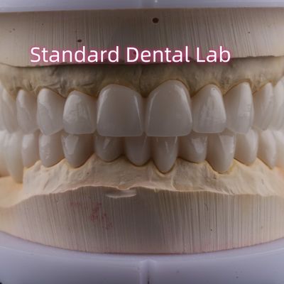 مختبر الأسنان القوس الكامل الزركونيا التاج البورسلين PFZ التاج ISO FDA CE