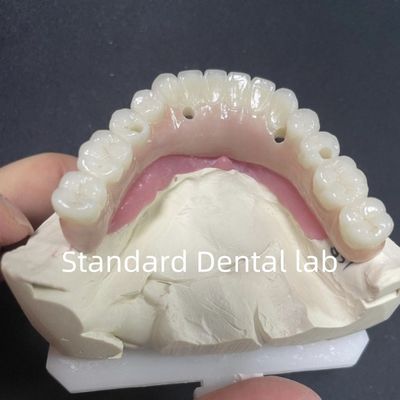 إعادة تجميل جميعها على 4 زراعة أسنان الزركونيا Hypo الحساسية