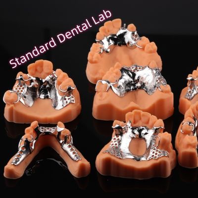 CAD CAM الإطار المعدني للطقم الأسناني الجزئي القابل للإزالة 3Shape Exocad Design