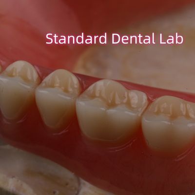 SDL الحرارة المعالجة الأكريليك جزء من الأسنان العضلية أسنان Ivoclar مختبر الأسنان دقة عالية