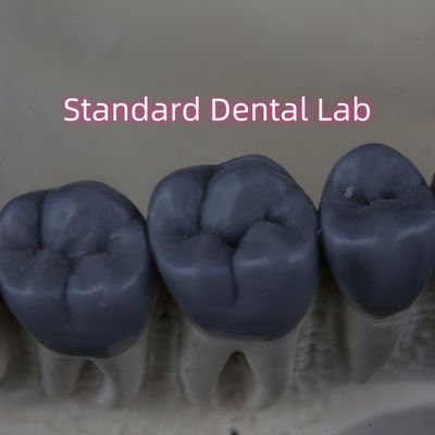 المختبر الأسنان الرقمي المهنية الشمع 3shape المعتمدة من قبل إدارة الأغذية والعقاقير