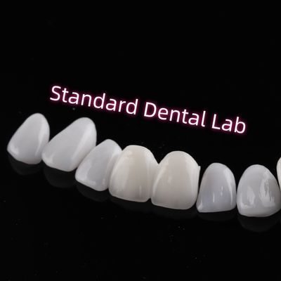 مقاومة للكشط Emax Zirconia الملمس القشرة الشفافية الشقية