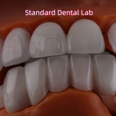ليتيم طبقة صلبة Ivoclar Emax Zirconia اللامينيات الشفافة OEM ODM