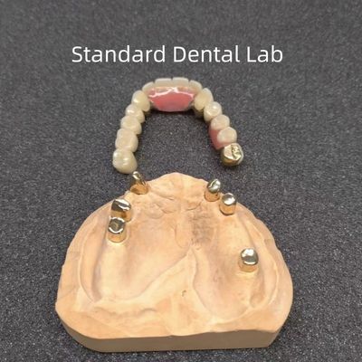 CAD CAM أسنان جزئية أسنان متعلقة طب الأسنان المهنية الدقيقة