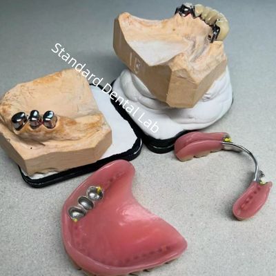 جماليات عالية CAD CAM الأسنان العضوية الجزئية استبدال العضوية المختبر الأسنان القياسية