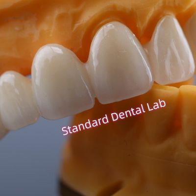 CAD CAM طاحونة زيركونيا الجسر التاجية متوافقة بيولوجيا للغاية
