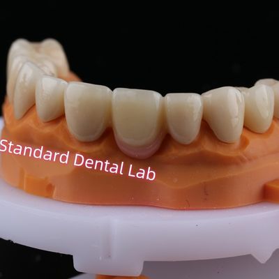 CAD CAM الرقمية طحن طبقات الزركونيا الجسر التاج مع البورسلين الوردي
