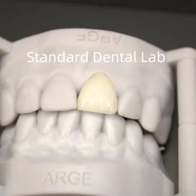 التاج الرقمي CAD CAM المختبر الأسنان الشفافة طبقة Zirconia التاج