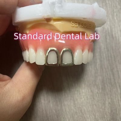 أسنان أكريليك كاملة مع أسنان ذهبية صفراء