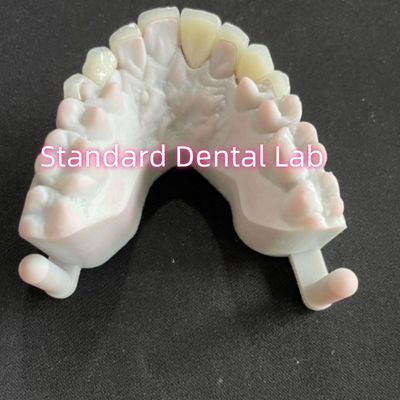 أسنان النجوم الابتسامة الأسنان Emax الزركونيا المصفوفة 0.6mm